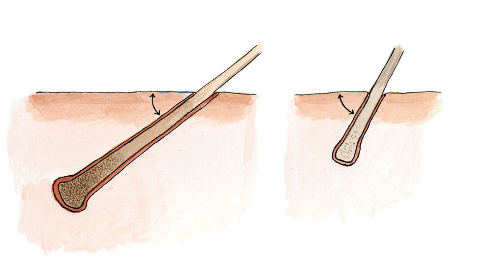 Hårrotens läge hos ett omoget respektive fullmoget skinn. Illustration: Göran Boström